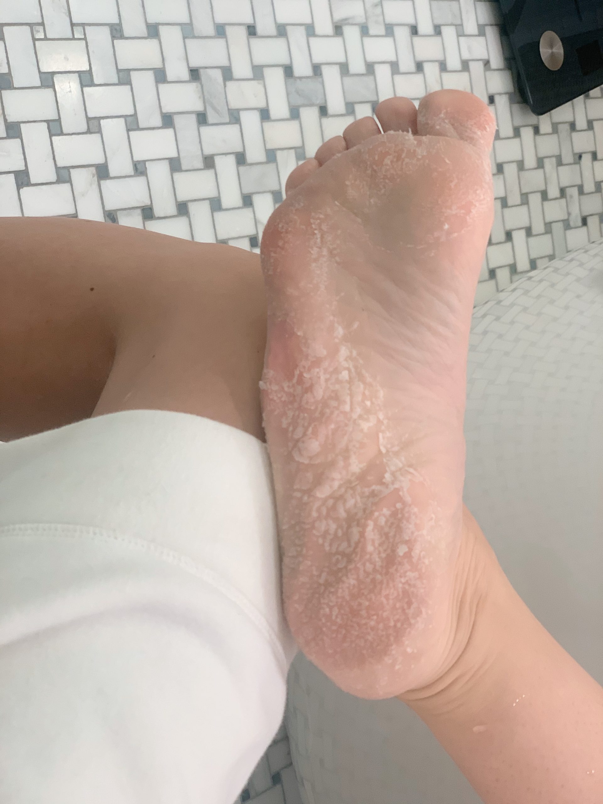 Baby Foot Peel Review: Results, Photos, and Before and After - The Skincare  Edit