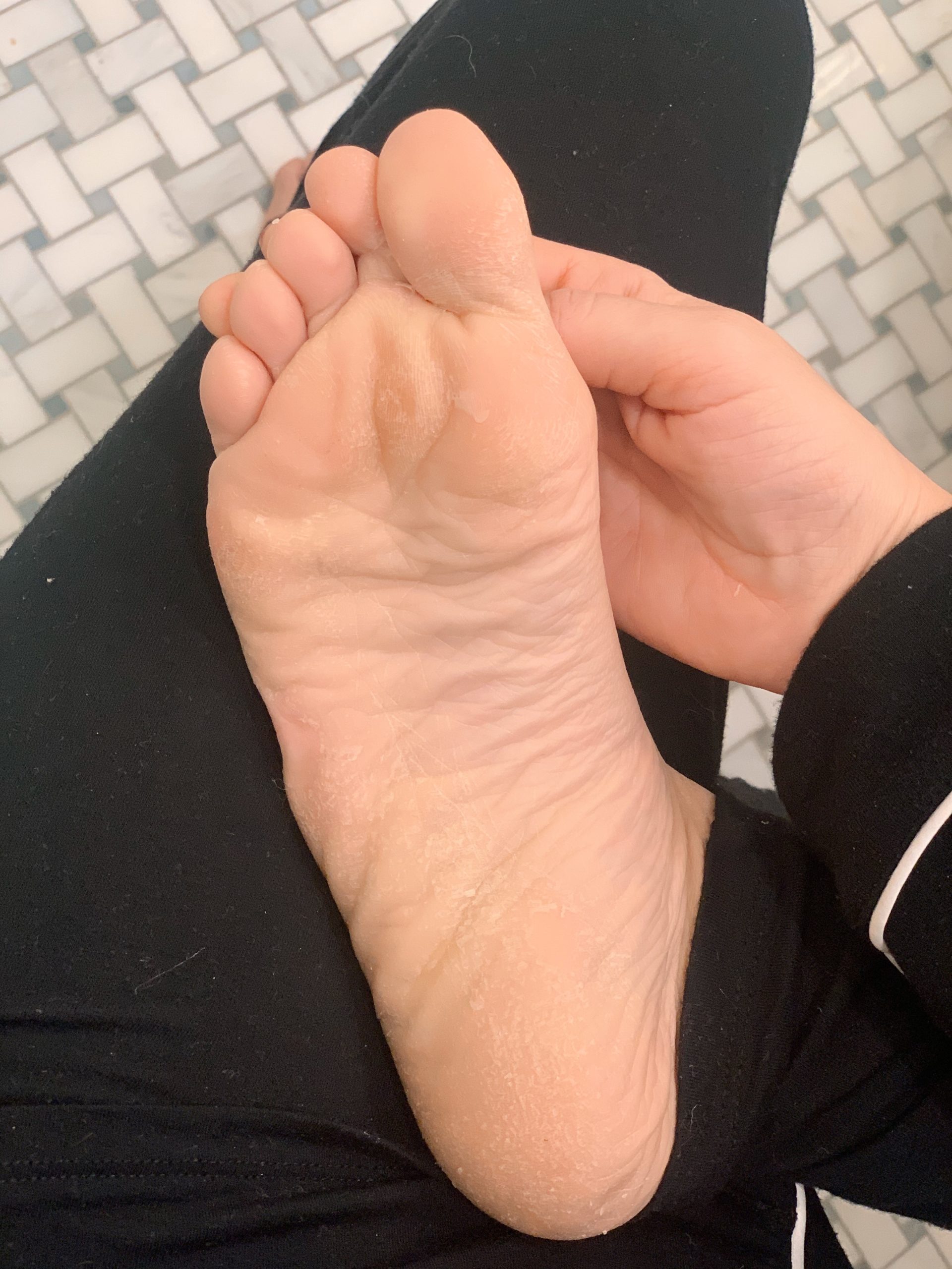 Before and after using foot wand! The results speak for themselves