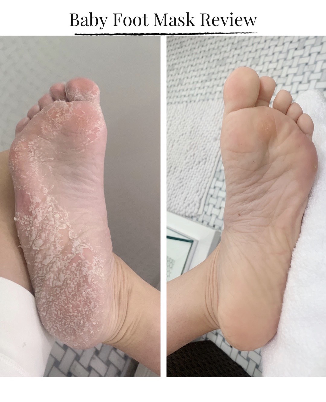 foot peel mask before and after