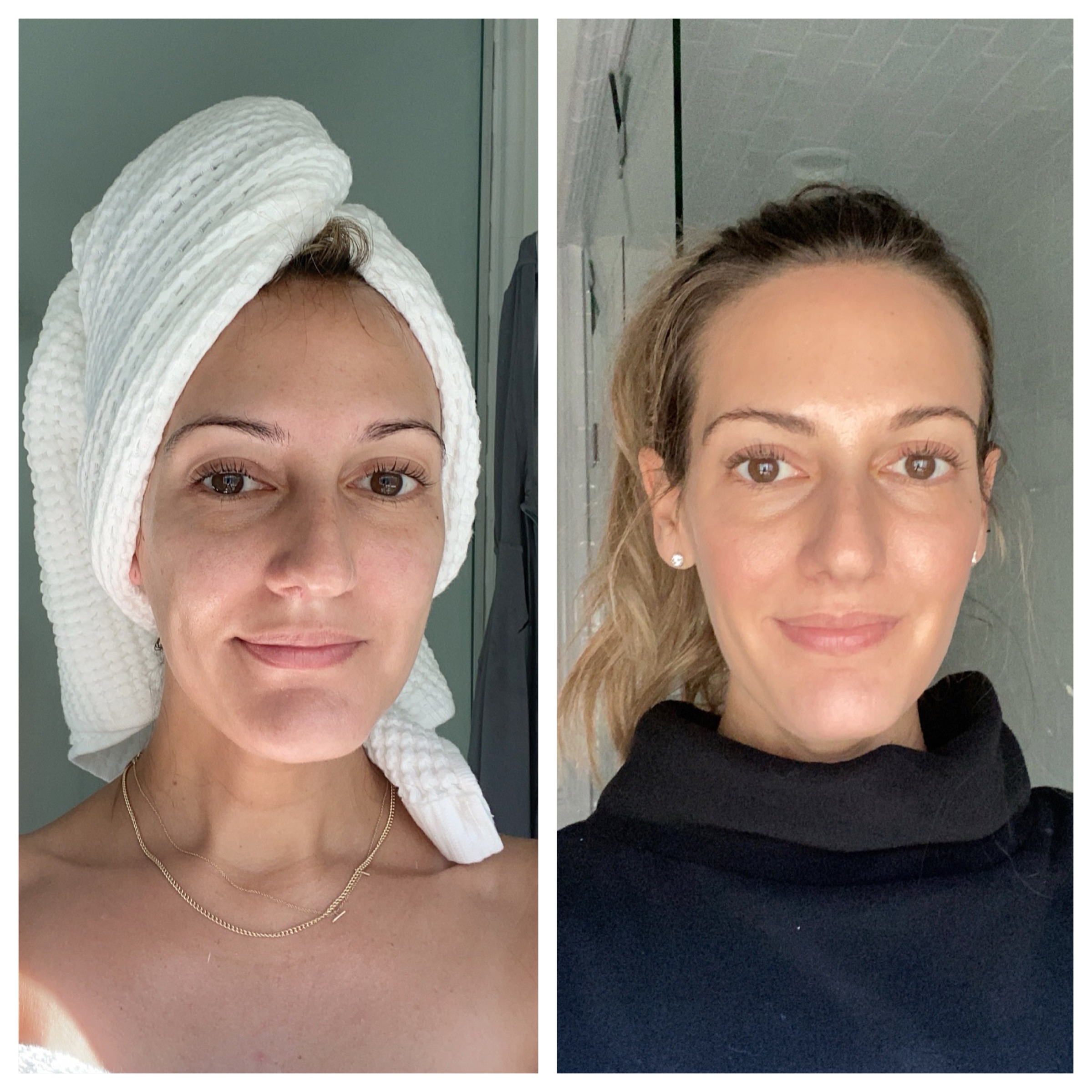 skin on face before and after Prescription Retinol Review